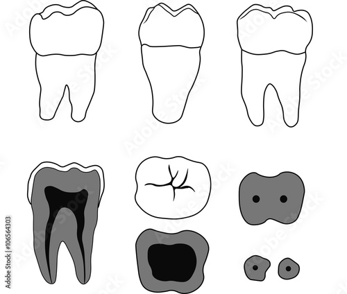 molar tooth