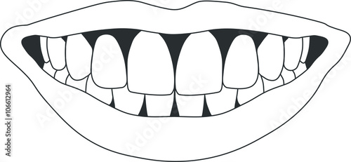 perfect smile