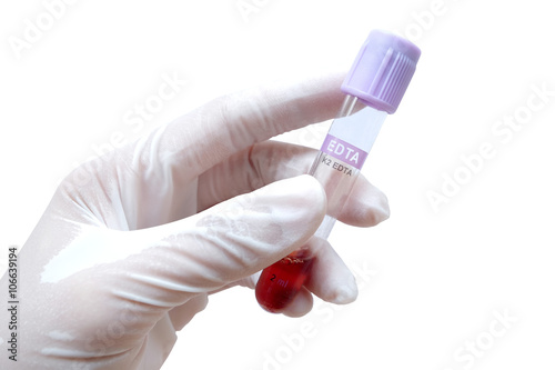purple plastic stopper (selected focus) on Di-EDTA blood collect