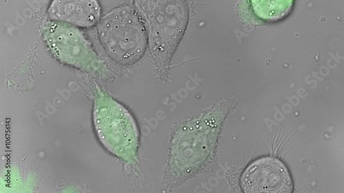 PC-3 human prostate cancer cell line is one of the cell lines used in prostate cancer research.
