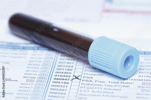 Color coded tube containing synthetic blood sample on a bloodwork requisition form that lists a test for prostate-specific antigen (PSA) photo