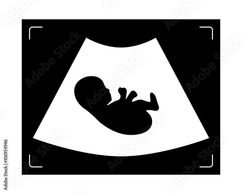 Medical ultrasonic diagnostic machine with embryo on screen