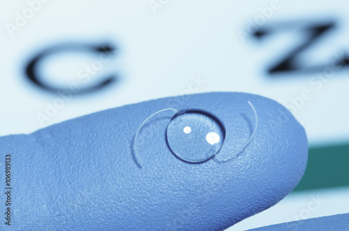 Intraocular lens on gloved finger.  Intraocular lens is an artificial lens surgically implanted in the human eye following extraction of the natural crystalline lens clouded by cataract.