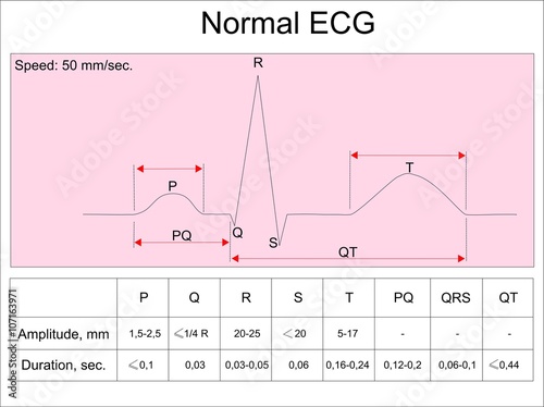 Scheme of  normal human ECG 