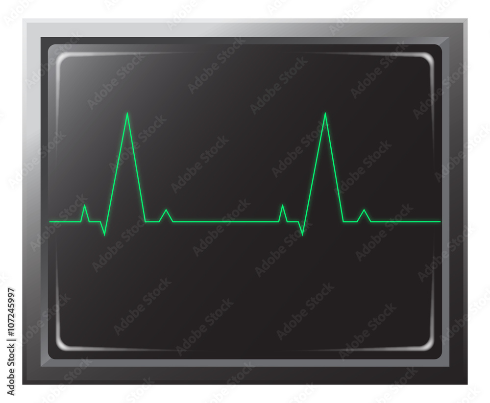 Heart Rate Monitor