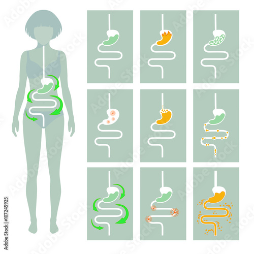 human digestive system, vector illustration of digestion tract disease