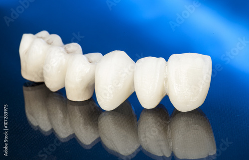 Canvastavla Metal free ceramic dental crowns