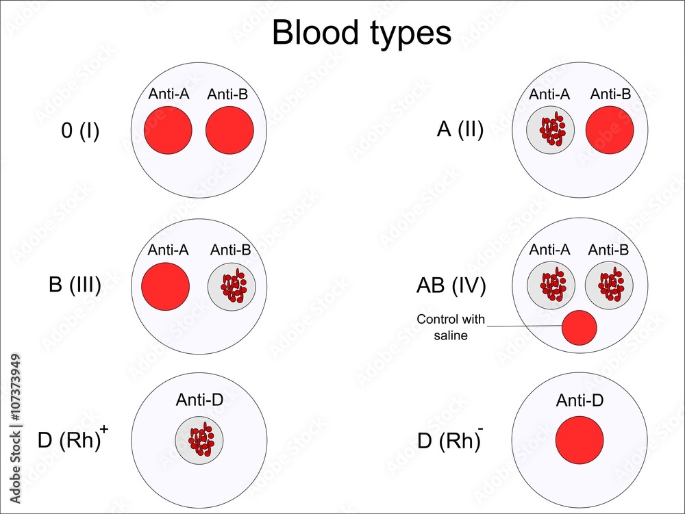 Determination of blood groups (types) with colyclons Stock Vector ...