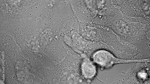 Movement, division and death of HeLa cervical cancer cells under microscope
