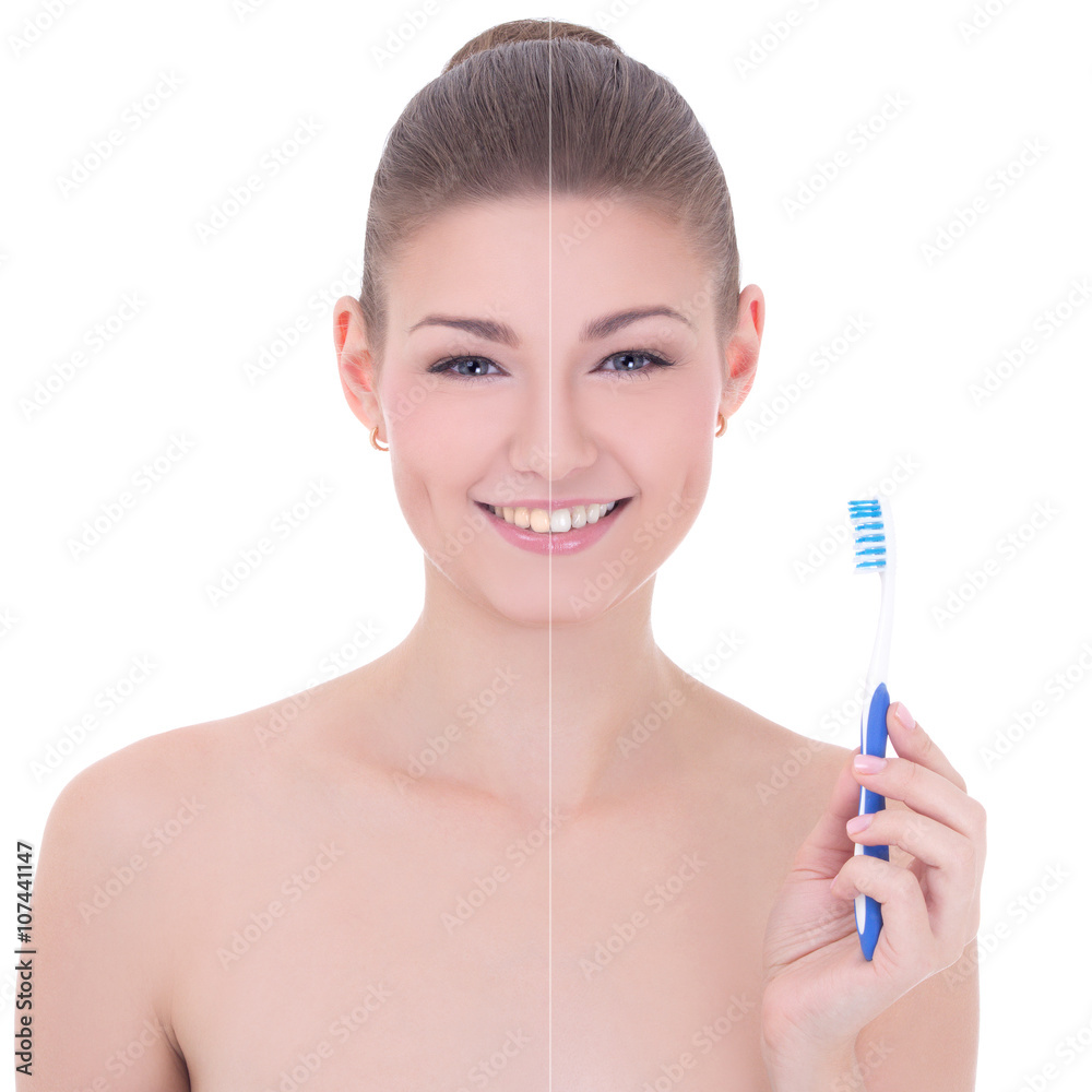 teeth whitening concept - portrait of young beautiful smiling wo teeth whitening concept - portrait of young beautiful smiling wo