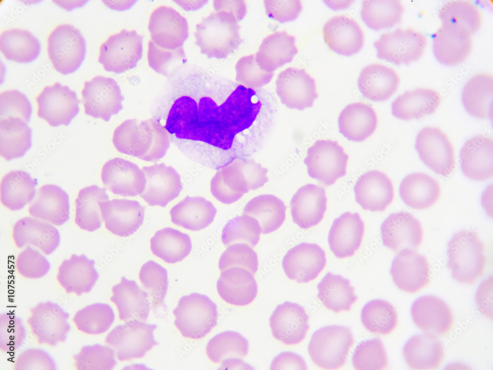 Monocyte cell (white blood cell) in peripheral blood smear, Wright stain
