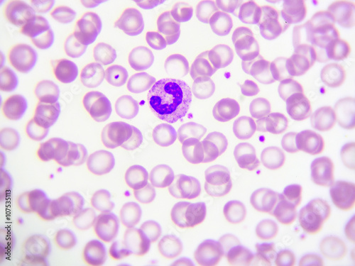 Band form neutrophil cell (white blood cell) in peripheral blood smear, Wright stain