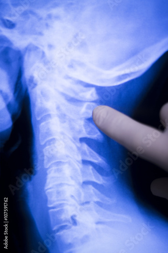Spine back neck xray scan