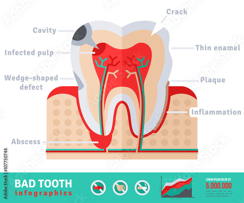 Bad tooth anatomy flat icon concept