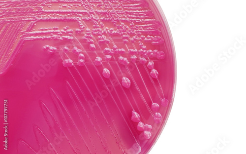 Canvas Print E.coli bacterial colonies on MacConkey agar plate
