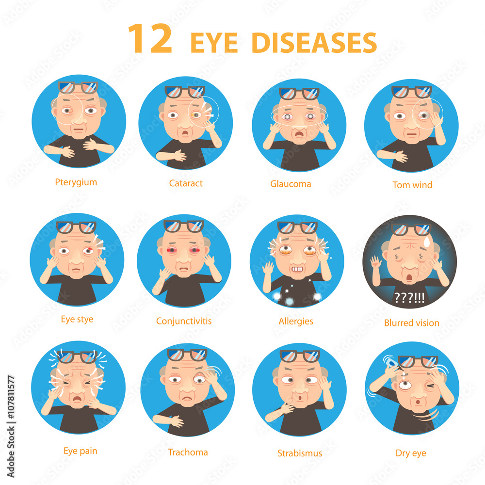 Eye diseases Eye Sick Eye Old Man diseases Circle, vector illustrationdiseases Eye diseases Eye Sick Eye Old Man diseases Circle, vector illustrationdiseases