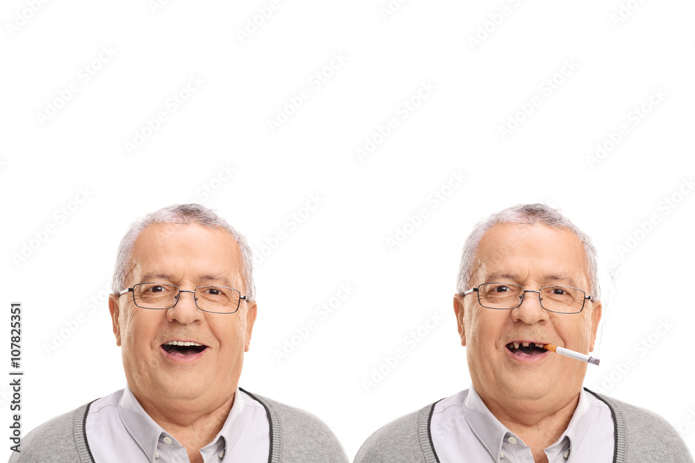 Photo of an elderly man showing the harmful effetcs of smoking Photo of an elderly man showing the harmful effetcs of smoking