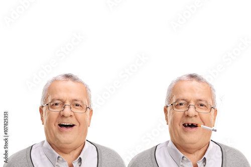 Photo of an elderly man showing the harmful effetcs of smoking photo