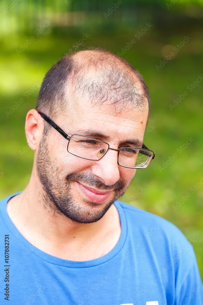 portrait of young man with bad eyesight and hair loss. portrait of young man with bad eyesight and hair loss.