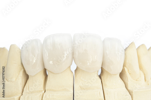 Metal free ceramic dental crowns