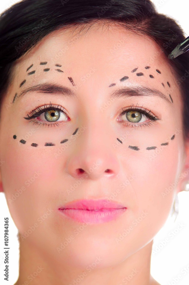 Headshot caucasian woman with dotted lines drawn around eyes looking into camera, preparing cosmetic surgery