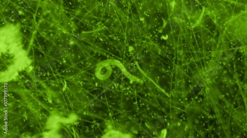 Nematode Worm Coiling In Microscope View at 100x photo