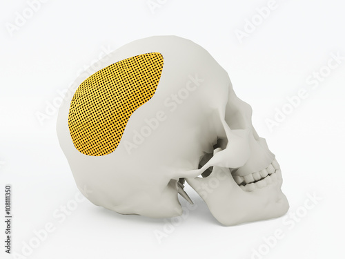 3d printed human skull. 3d printed implants on white background. 3d illustration.