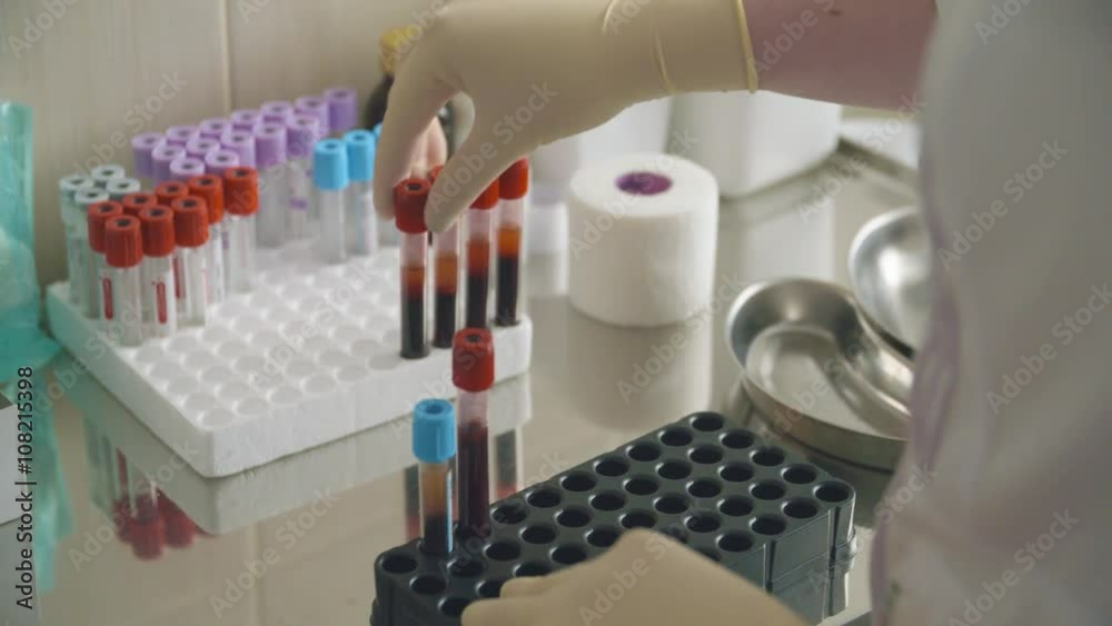 Unrecognizable nurse taking tubes with blood samples Unrecognizable nurse taking tubes with blood samples
