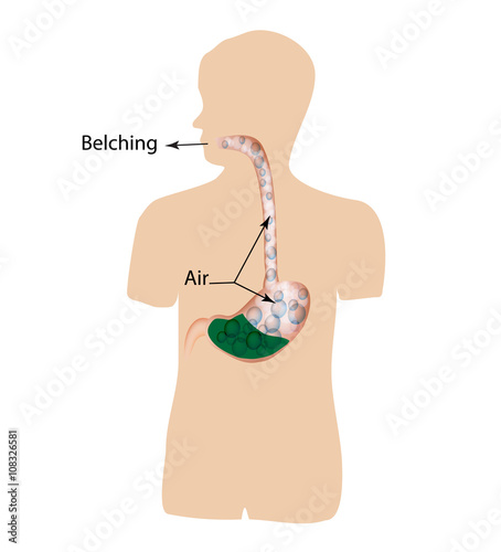 Belching. Air in the stomach. The structure of the esophagus and stomach. Infographics. Vector illustration