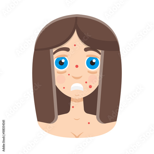  girl pimples, girl acne