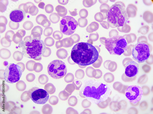 Kind of white blood cell (WBC) in blood smear