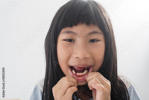 Asian child has lost the baby tooth