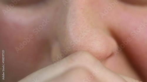 Person having allergy and rubbing nose. Health problems. Close-up view photo