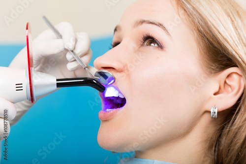 The reception was at the female dentist. Doctor examines the oral cavity on tooth decay. Caries protection. Tooth decay treatment. Dentist working with dental polymerization lamp in oral cavity