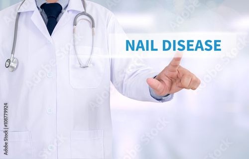 NAIL DISEASE photo