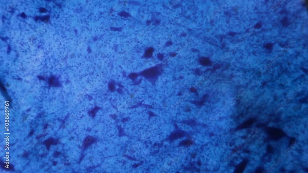 Nerve cell under the microscope - Abstract blue dots on white background.