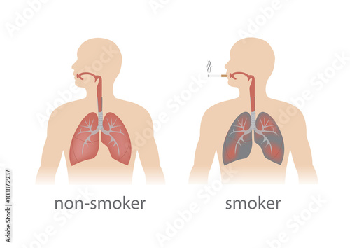 smoker and non smoker lungs comparison. vector format.