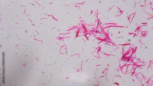 Smooth muscle separate under the microscope - Abstract pink lines on white background. photo