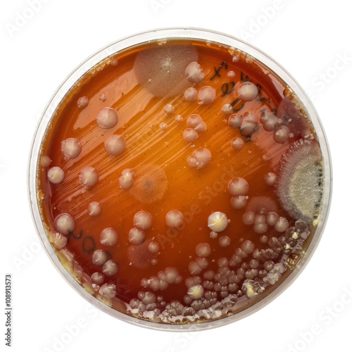 Petri dish with bacteria colonies and mold
