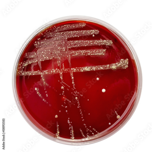 Petri dish with bacteria colonies