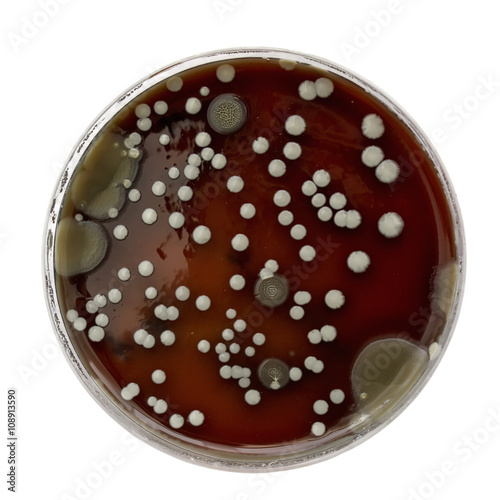 Petri dish with bacteria colonies
