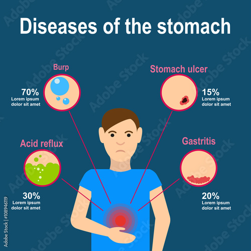 Stomach pain infografics
Causes of stomach pain. Burp, heartburn, gastritis and stomach ulcers. Flat design. Vector illustration