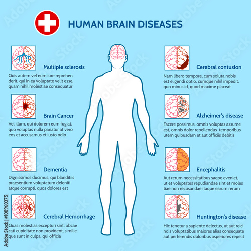 Mental Health and human brain diseases medical infographics vector illustration