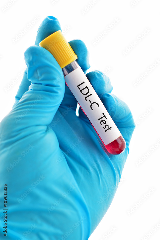 Obraz premium LDL cholesterol (LDL-C) test 