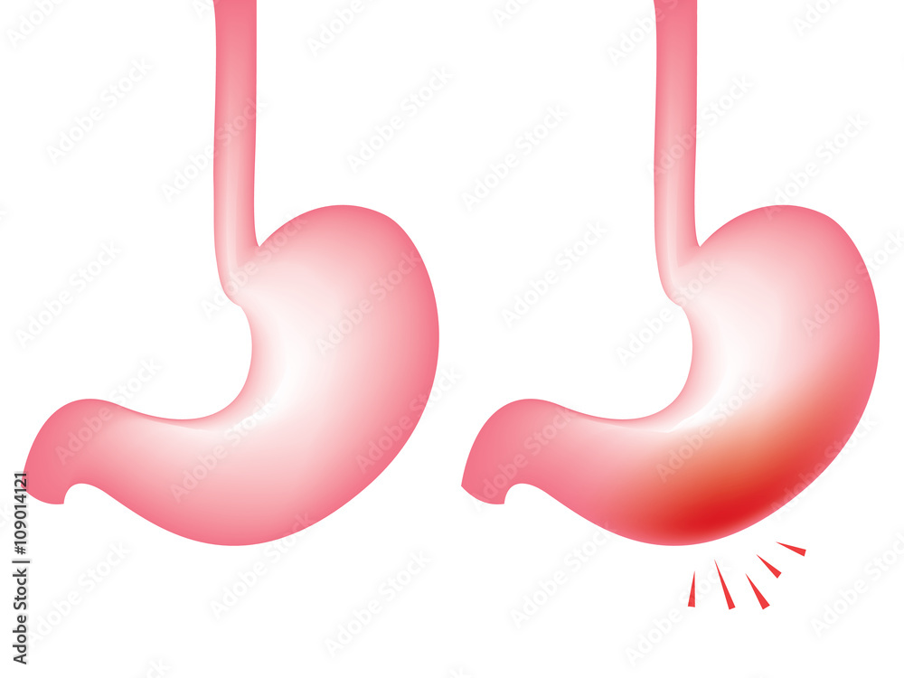 Human's Stomach, Good and Pain concept. Illustration isolated on white background Human's Stomach, Good and Pain concept. Illustration isolated on white background