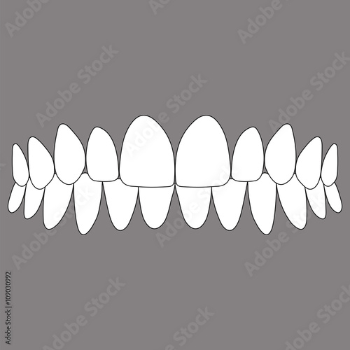 occlusion