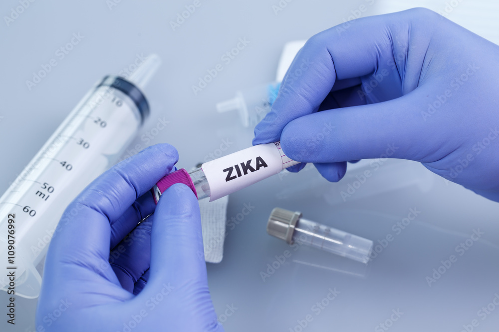 Blood collection tubes with labels Zika virus