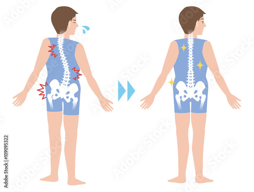 chiropractic before after image, from bad posture to good posture, man's body and backbone, vector illustration