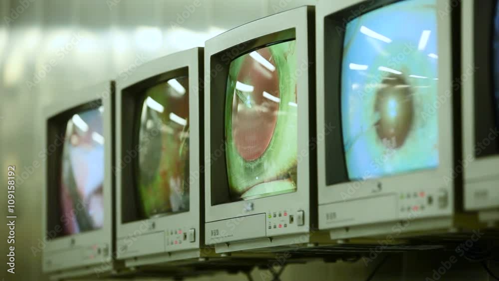 Macro Image of Eyes on Displays During Eye Surgery. Ophthalmology Macro Image of Eyes on Displays During Eye Surgery. Ophthalmology