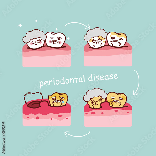 senior tooth with periodontal disease